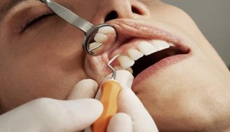 Dental Treatments